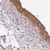 Anti-ST13 antibody produced in rabbit Prestige Antibodies&#174; Powered by Atlas Antibodies, affinity isolated antibody, buffered aqueous glycerol solution