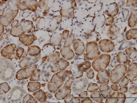 Monoclonal Anti-FBXL18 antibody produced in mouse clone 3H5, purified immunoglobulin, buffered aqueous solution