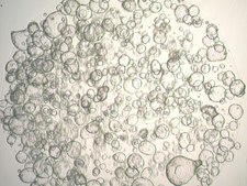 3dGRO Colon Intestinal Organoids, Age 24 (Prep ht-206-CR) Crohns, Colon, Age: 24, Female, Mutation: Not Available