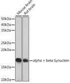 Anti-alpha + beta Synuclein Antibody, clone 9E9X5, Rabbit Monoclonal