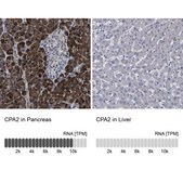 Anti-CPA2 antibody produced in rabbit Prestige Antibodies® Powered by Atlas Antibodies, affinity isolated antibody, buffered aqueous glycerol solution, Ab1