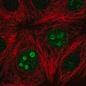 Anti-SETD7 antibody produced in rabbit Prestige Antibodies&#174; Powered by Atlas Antibodies, affinity isolated antibody, buffered aqueous glycerol solution