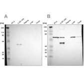 Anti-SPARC antibody produced in rabbit Ab1, Prestige Antibodies&#174; Powered by Atlas Antibodies, affinity isolated antibody, buffered aqueous glycerol solution