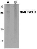 Anti-MOSPD1 antibody produced in rabbit affinity isolated antibody, buffered aqueous solution