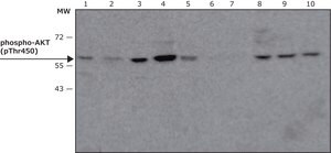 Anti-phospho-AKT (pThr450) antibody, Mouse monoclonal clone AK-11, purified from hybridoma cell culture