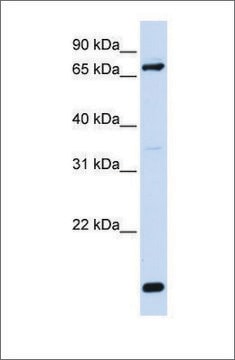 Anti-ACSL4 antibody produced in rabbit affinity isolated antibody