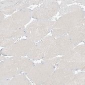 Anti-ZDHHC4 antibody produced in rabbit Prestige Antibodies® Powered by Atlas Antibodies, affinity isolated antibody, buffered aqueous glycerol solution