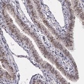 Anti-PRICKLE1 antibody produced in rabbit Prestige Antibodies® Powered by Atlas Antibodies, affinity isolated antibody, buffered aqueous glycerol solution