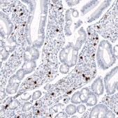Monoclonal Anti-S100A9 antibody produced in mouse Prestige Antibodies® Powered by Atlas Antibodies, clone CL11191, purified antibody (Protein A)