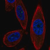 Anti-TSACC antibody produced in rabbit Prestige Antibodies&#174; Powered by Atlas Antibodies, affinity isolated antibody, buffered aqueous glycerol solution