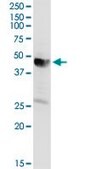 Anti-AACS antibody produced in rabbit purified immunoglobulin, buffered aqueous solution