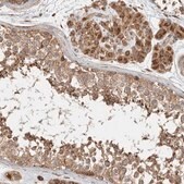 Anti-TUBD1 antibody produced in rabbit Prestige Antibodies&#174; Powered by Atlas Antibodies, affinity isolated antibody, buffered aqueous glycerol solution, Ab2