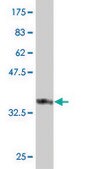 Monoclonal Anti-FBXO36 antibody produced in mouse clone 3D3, purified immunoglobulin, buffered aqueous solution