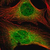 Anti-ZNF569 antibody produced in rabbit Prestige Antibodies® Powered by Atlas Antibodies, affinity isolated antibody, buffered aqueous glycerol solution