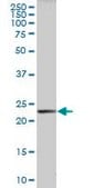 Anti-HRASLS3 antibody produced in mouse purified immunoglobulin, buffered aqueous solution