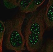 Anti-ZNF395 antibody produced in rabbit Prestige Antibodies® Powered by Atlas Antibodies, affinity isolated antibody, buffered aqueous glycerol solution