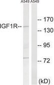 Anti-IGF1R antibody produced in rabbit affinity isolated antibody