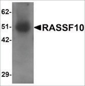 Anti-RASSF10 antibody produced in rabbit affinity isolated antibody