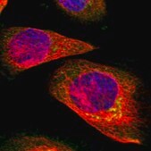 Anti-SUN3 antibody produced in rabbit Prestige Antibodies&#174; Powered by Atlas Antibodies, affinity isolated antibody, buffered aqueous glycerol solution
