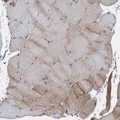 Anti-LSM14B antibody produced in rabbit Prestige Antibodies&#174; Powered by Atlas Antibodies, affinity isolated antibody, buffered aqueous glycerol solution