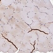 Anti-ZW10 antibody produced in rabbit Prestige Antibodies&#174; Powered by Atlas Antibodies, affinity isolated antibody, buffered aqueous glycerol solution
