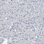 Anti-NUDCD3 antibody produced in rabbit Prestige Antibodies&#174; Powered by Atlas Antibodies, affinity isolated antibody, buffered aqueous glycerol solution, Ab3
