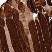 Anti-ETFBKMT antibody produced in rabbit Prestige Antibodies® Powered by Atlas Antibodies, affinity isolated antibody, buffered aqueous glycerol solution