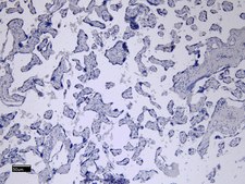 Anti-CD32/FCGR2B antibody produced in goat affinity isolated antibody, buffered aqueous solution