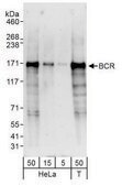 Rabbit anti-BCR Antibody, Affinity Purified Powered by Bethyl Laboratories, Inc.