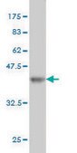 Monoclonal Anti-PCMT1 antibody produced in mouse clone 1D6, purified immunoglobulin, buffered aqueous solution