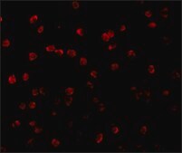 Anti-RPS6K1 antibody produced in rabbit affinity isolated antibody, buffered aqueous solution