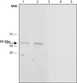 Anti-Calsequestrin-2 antibody produced in rabbit ~1.0&#160;mg/mL, affinity isolated antibody, buffered aqueous solution