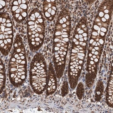 Anti-CFDP1 antibody produced in rabbit Prestige Antibodies&#174; Powered by Atlas Antibodies, affinity isolated antibody, buffered aqueous glycerol solution