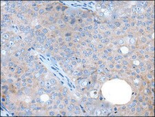 Anti-WAPL affinity isolated antibody