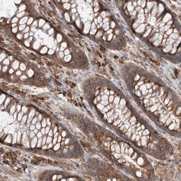 Anti-ACAP2 antibody produced in rabbit Prestige Antibodies&#174; Powered by Atlas Antibodies, affinity isolated antibody, buffered aqueous glycerol solution
