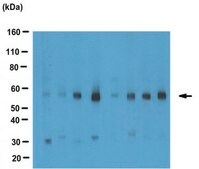 Anti-ACAT-2 Antibody from rabbit, purified by affinity chromatography