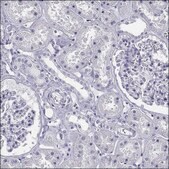 Anti-IRG1 antibody produced in rabbit Prestige Antibodies® Powered by Atlas Antibodies, affinity isolated antibody, buffered aqueous glycerol solution