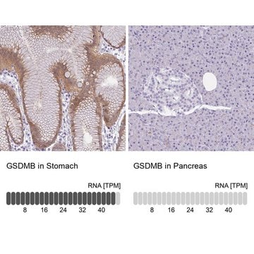 Anti-GSDMB antibody produced in rabbit Prestige Antibodies&#174; Powered by Atlas Antibodies, affinity isolated antibody, buffered aqueous glycerol solution