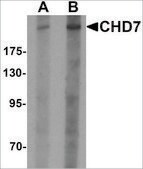 Anti-CHD7 antibody produced in rabbit affinity isolated antibody