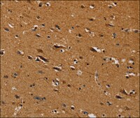 Anti-CENPU antibody produced in rabbit affinity isolated antibody