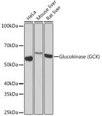 Anti-Glucokinase (GCK) Antibody, clone 4K9D5, Rabbit Monoclonal