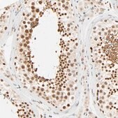 Anti-DAZAP1 antibody produced in rabbit Ab2, Prestige Antibodies&#174; Powered by Atlas Antibodies, affinity isolated antibody, buffered aqueous glycerol solution