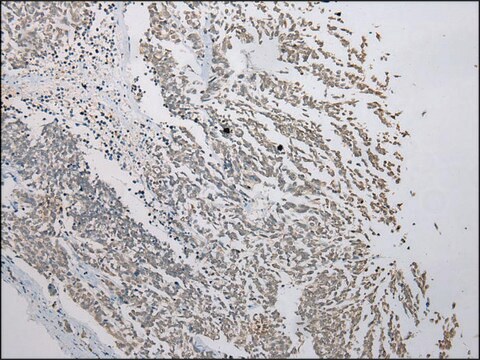 Anti-FAM101A affinity isolated antibody