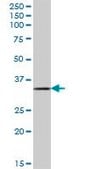 Anti-DHRSX antibody produced in mouse purified immunoglobulin, buffered aqueous solution
