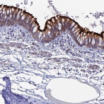 Anti-TMEM161A antibody produced in rabbit Prestige Antibodies&#174; Powered by Atlas Antibodies, affinity isolated antibody, buffered aqueous glycerol solution
