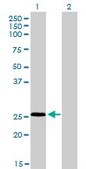 Monoclonal Anti-RNF141 antibody produced in mouse clone 6D9, purified immunoglobulin, buffered aqueous solution