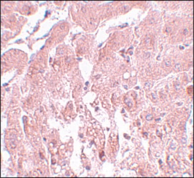 Anti-SUMO2/3 antibody produced in rabbit affinity isolated antibody, buffered aqueous solution