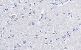 Anti-BDNF Antibody, clone 1I14 ZooMAb&#174; Rabbit Monoclonal recombinant, expressed in HEK 293 cells