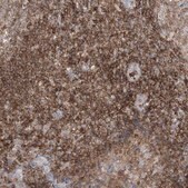 Anti-ARHGAP30 antibody produced in rabbit Prestige Antibodies&#174; Powered by Atlas Antibodies, affinity isolated antibody, buffered aqueous glycerol solution