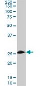 Monoclonal Anti-RNF141 antibody produced in mouse clone 6D9, purified immunoglobulin, buffered aqueous solution